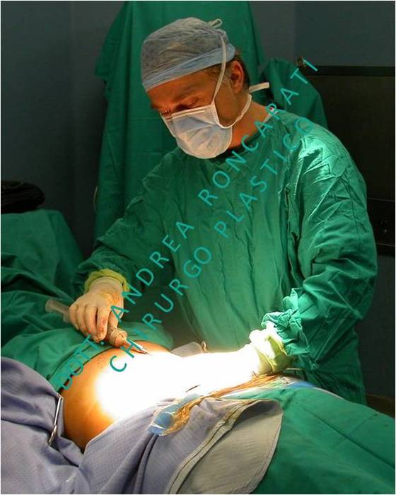 DOTT. ANDREA RONCARATI - LIPOFILLING
